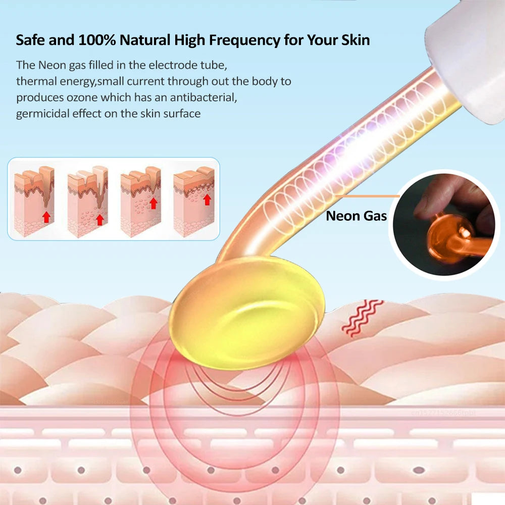 Radiant Skin Electrotherapy Wand™